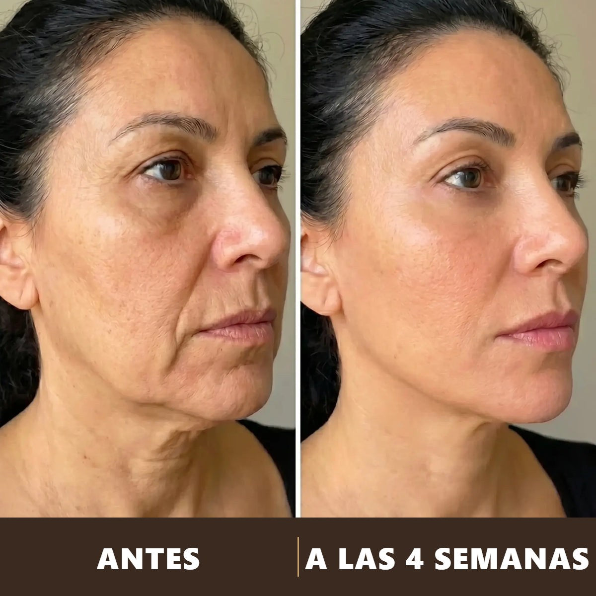 Antes y a las 4 semanas de usar el cepillo