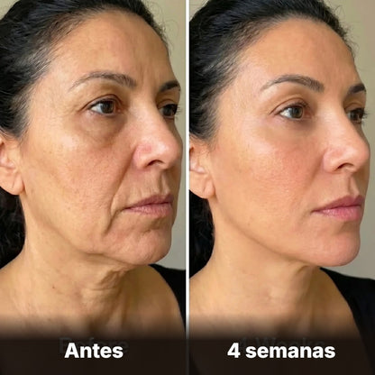 Cepillo de drenaje facial Nivora