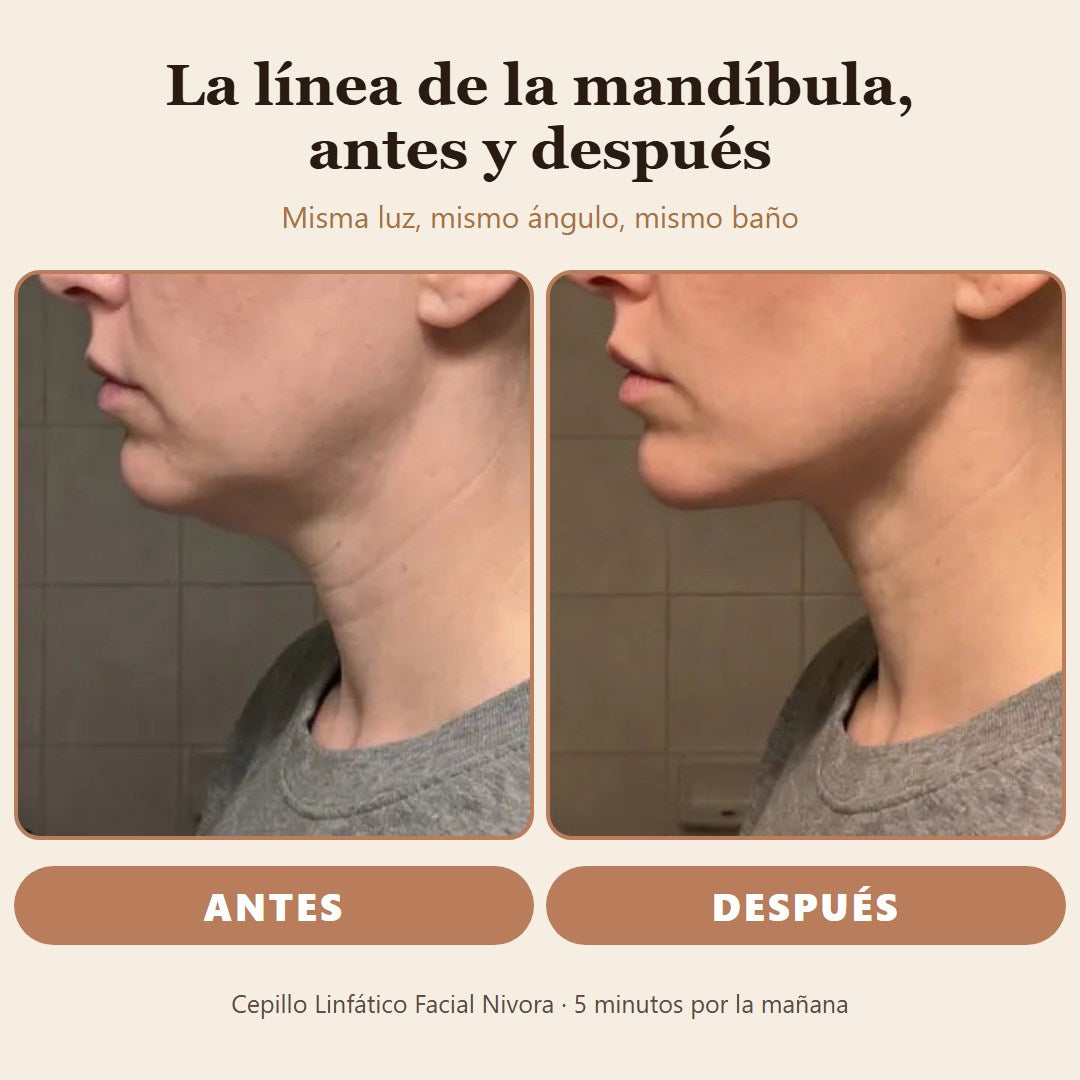 La línea de la mandíbula, antes y después