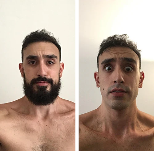 Antes y después