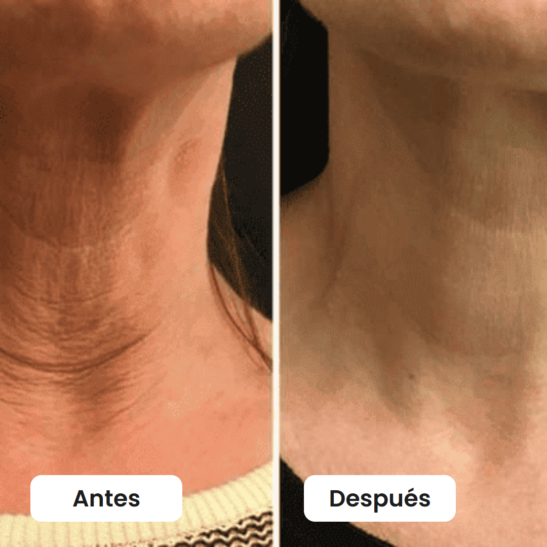 Antes y después del cuello