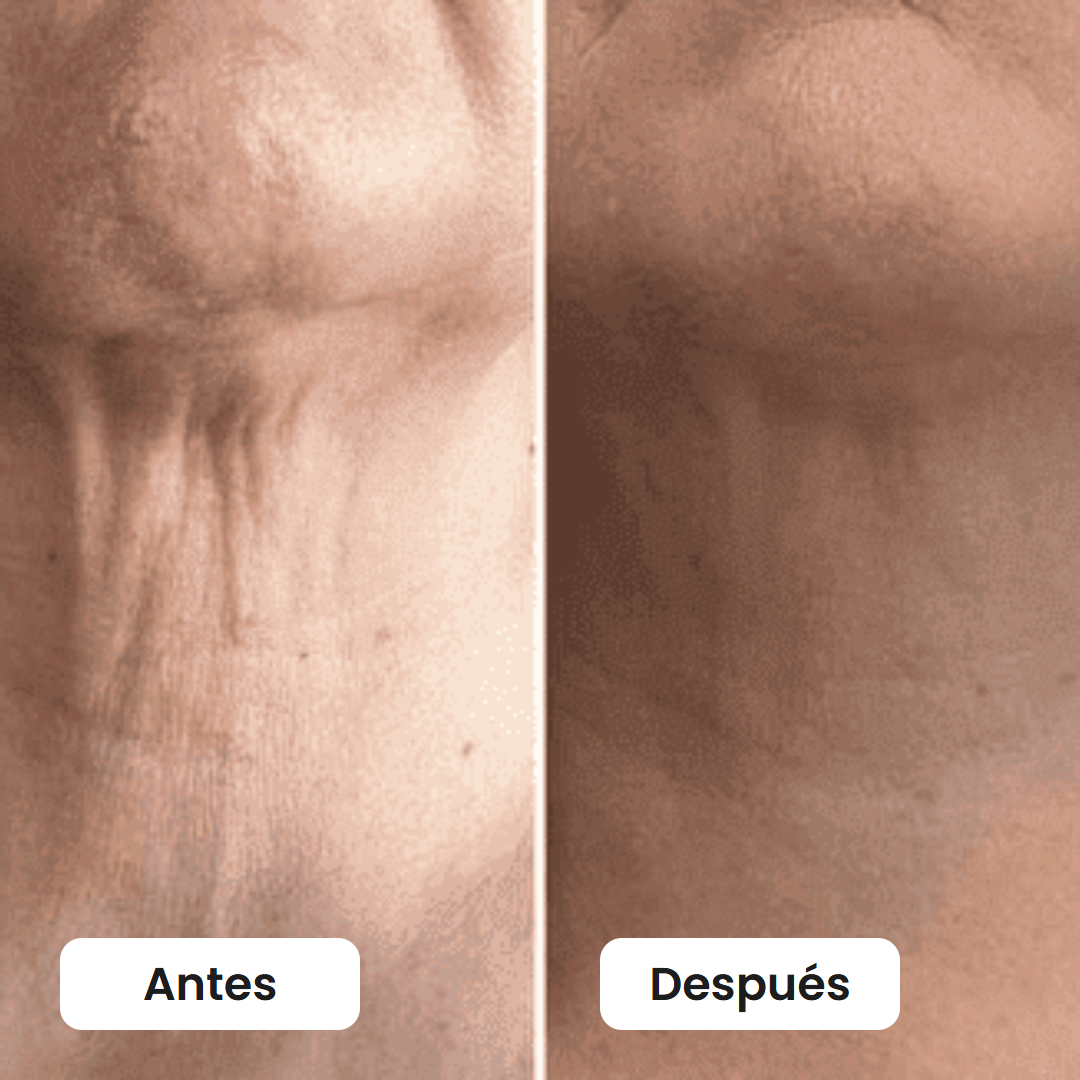 Antes y después del cuello