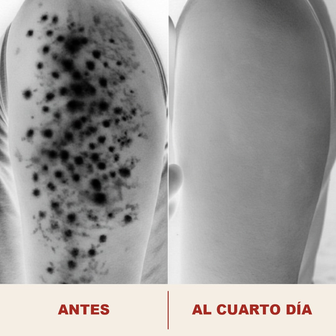 Acercamiento del poro antes y al cuarto dia