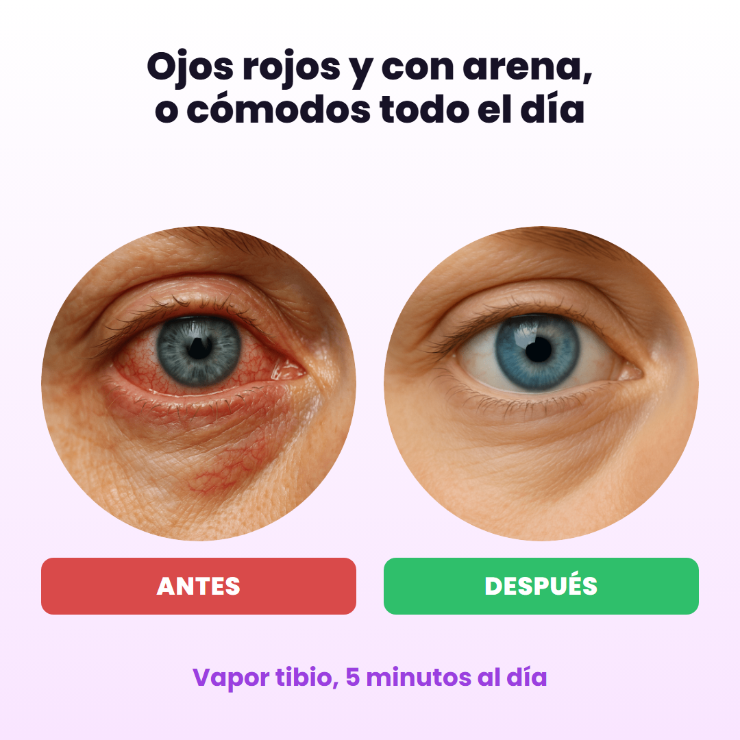Ojos rojos antes y ojos cómodos después