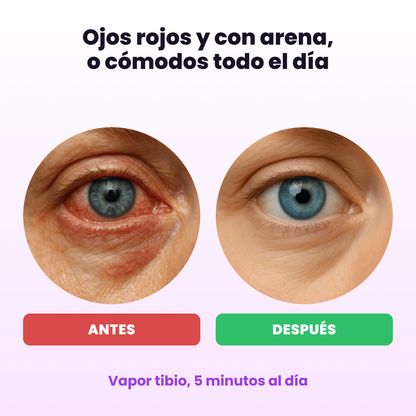 Ojos rojos antes y ojos cómodos después